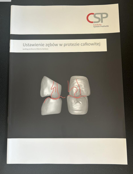 Ustawienie zębów w protezie całkowitej